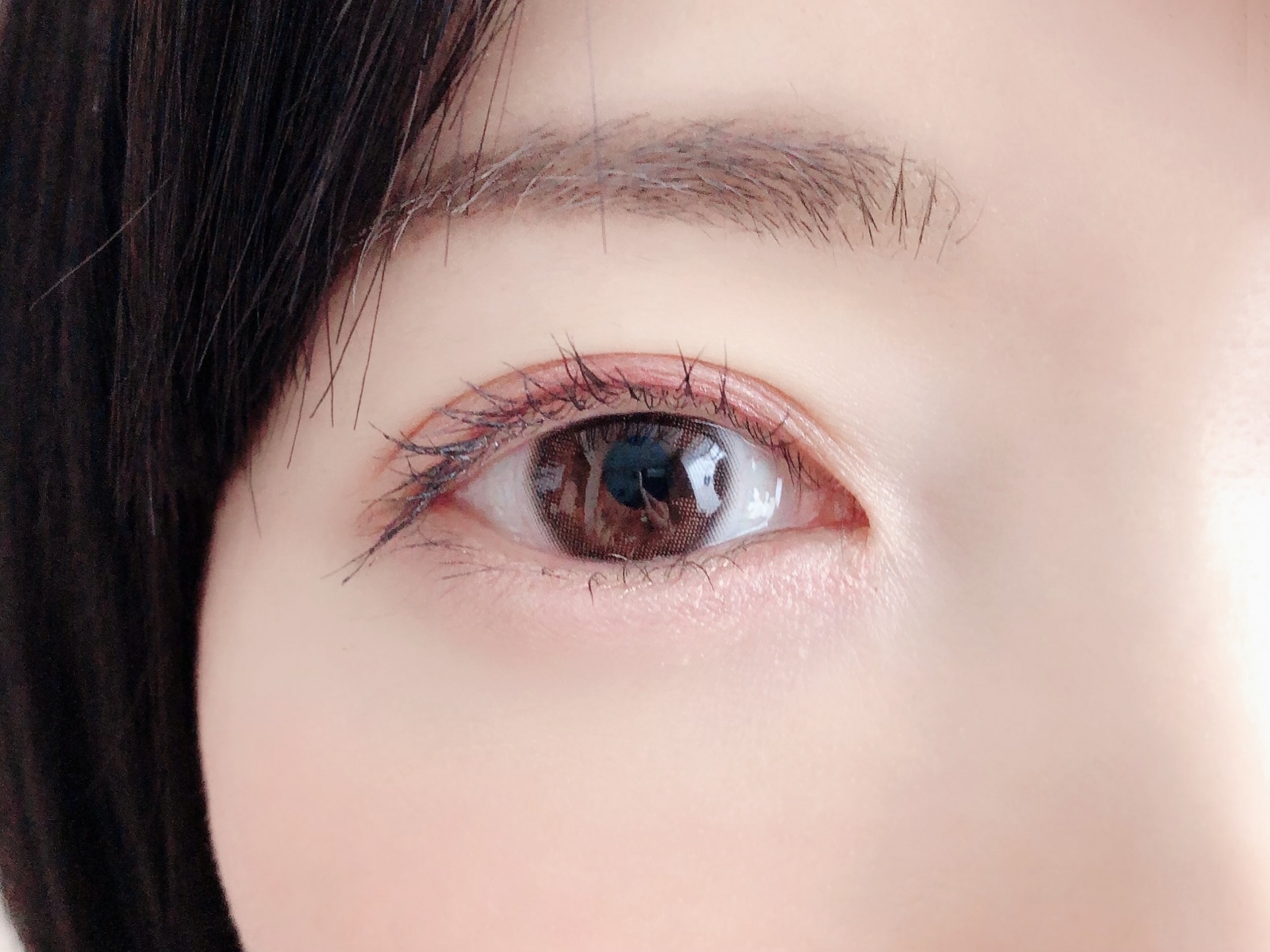 白目 に 血